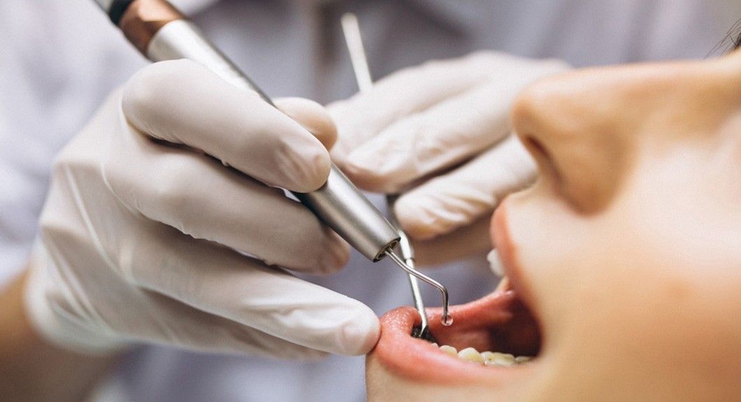 في عيادة لبنانية.. جَمّل أسنانه وهرب!