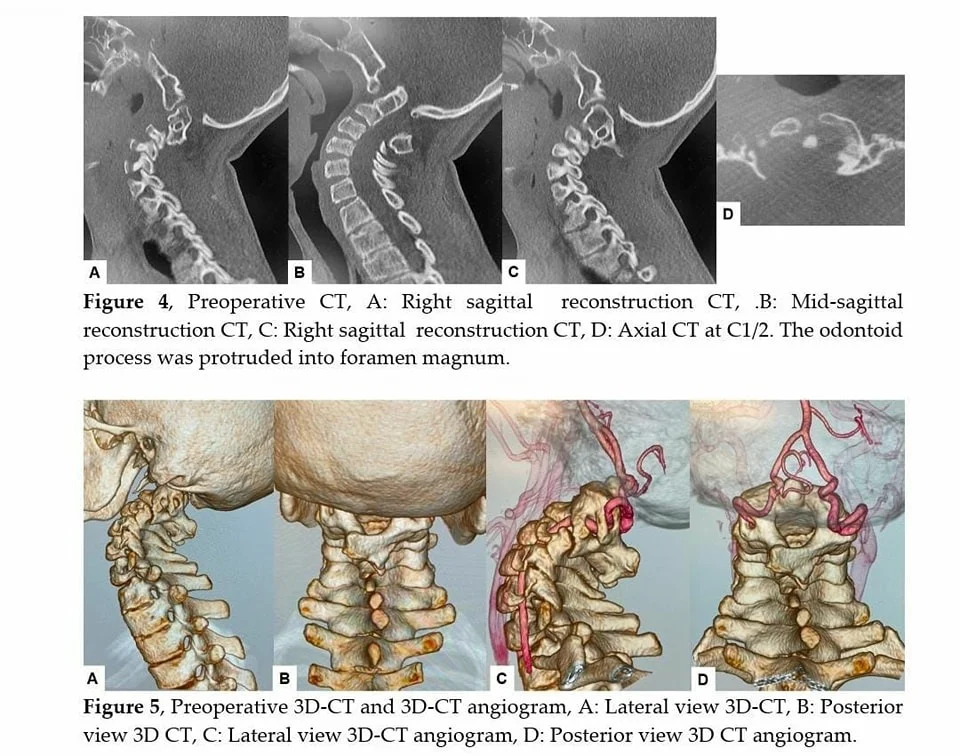 إنجاز طبّي لبناني في اليابان ! – image 18