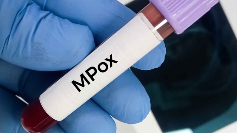 مجددًا… جدري القردة يثير قلق العالم  – جدرة القردة