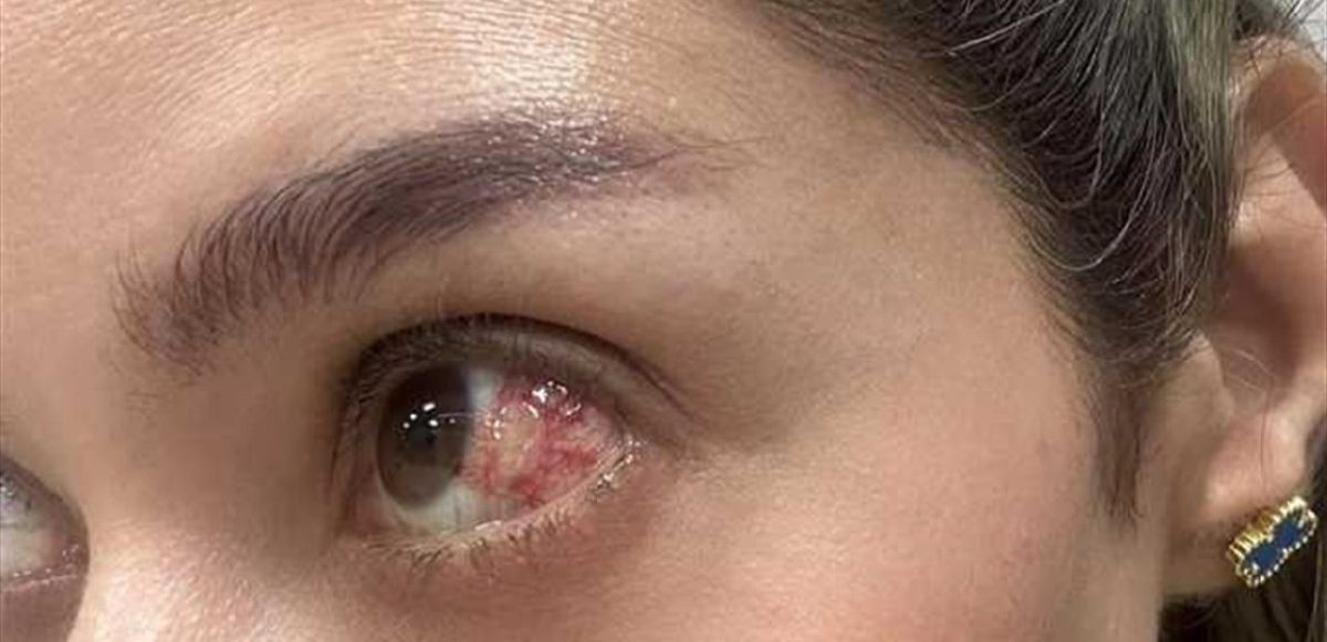 بالصورة خطأ طبي كاد يفقدها بصرها.. فنانة شهيرة تروي ما حصل معها وتحذر – IMG 20250626 110603 433 1200x581 1