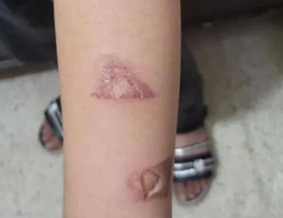 بالصورة - عسكري يعنف ابنته وزوجته تحرقها.  – telegram cloud photo size 1 4911281213508005808