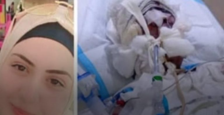 أحرق زوجته بالزيت ورماها واختفى… والأمن بالمرصاد!